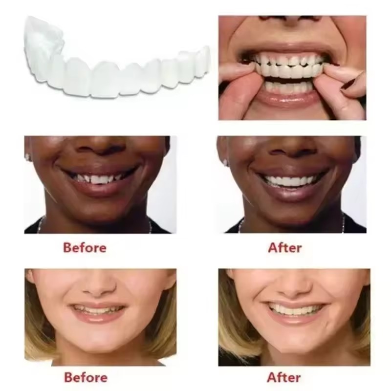 Teeth Veneers Whitening Dentur - Teeth Whitening Kit 评论和价格