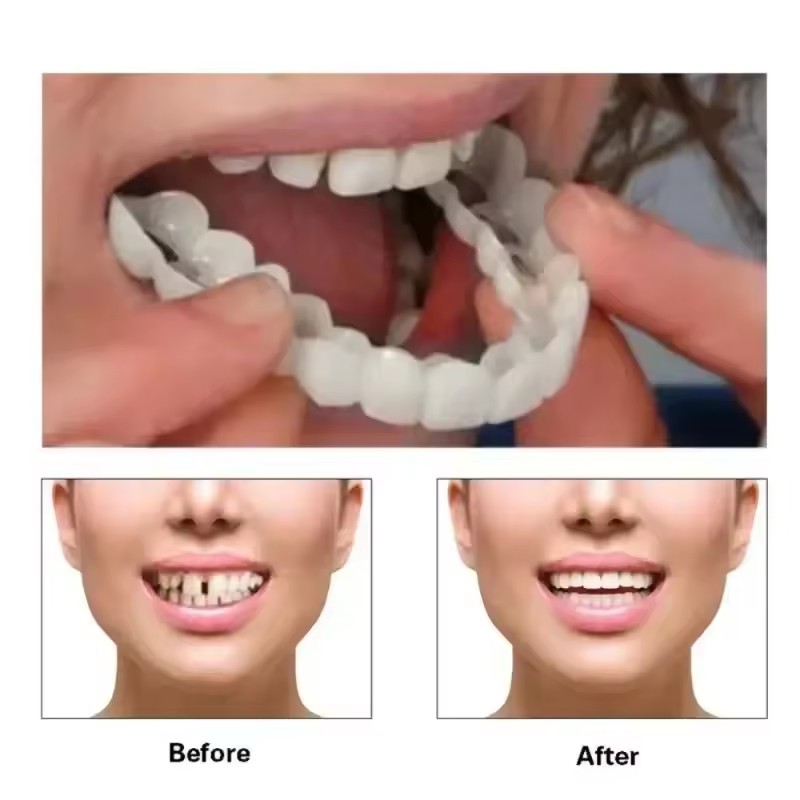 Teeth Veneers Whitening Dentur - Teeth Whitening Kit 评论和价格