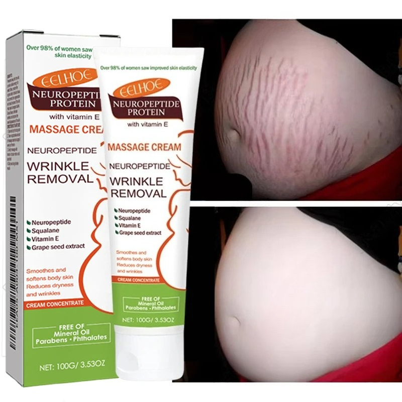 100g Stretch Marks Permanent R - Teeth Whitening Pregnancy 评论和价格